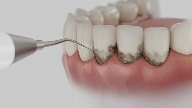 Trusted Tooth Extraction service in Glendale, CO - Dentist Open Now